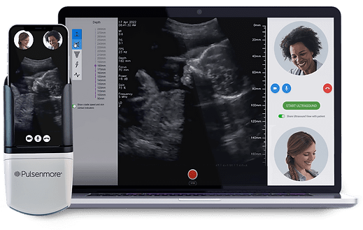 Pulsenmore Clinician-Guided Home Ultrasound
