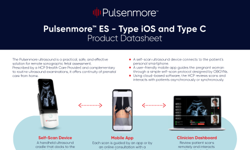 Pulsenmore ES product specifications