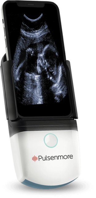 ultrasound-device