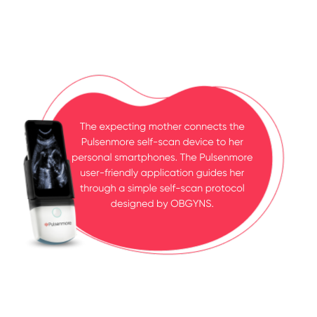 The expecting mother connects the Pulsenmore self-scan device to her personal smartphones. The Pulsenmore user-friendly application guides her through a simple self-scan protocol designed by OBGYNS.