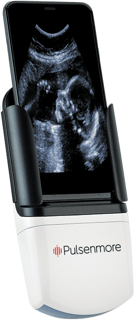 ultrasound-device