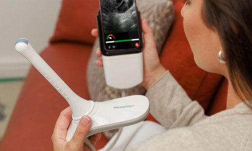 Pulsenmore FC at-home ultrasound for follicular monitoring